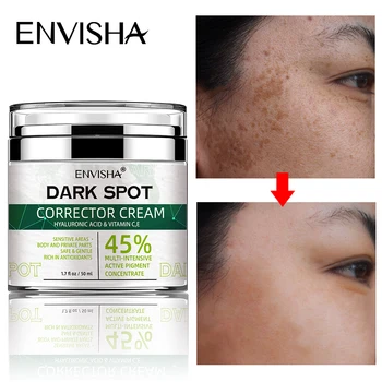 ENVISHA顔の肌の美白Freckleクリームを削除Melasmaダークスポットのメラニン抗加齢軽量化収縮毛穴の保湿成分